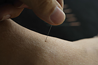 acupuncture needle being inserted - Ellery Chua
