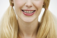 close up of Young woman with braces and pigtails - Alex Mares-Manton