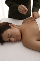 therapist applying acupuncture needle treatment - Nugene Chiang